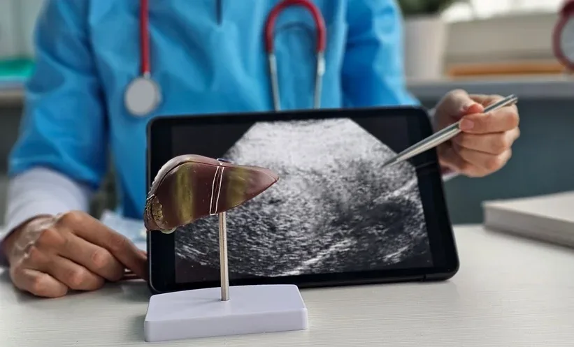 AI Model Achieves 0.89 AUC in Predicting Diabetes Risk for NAFLD Patients