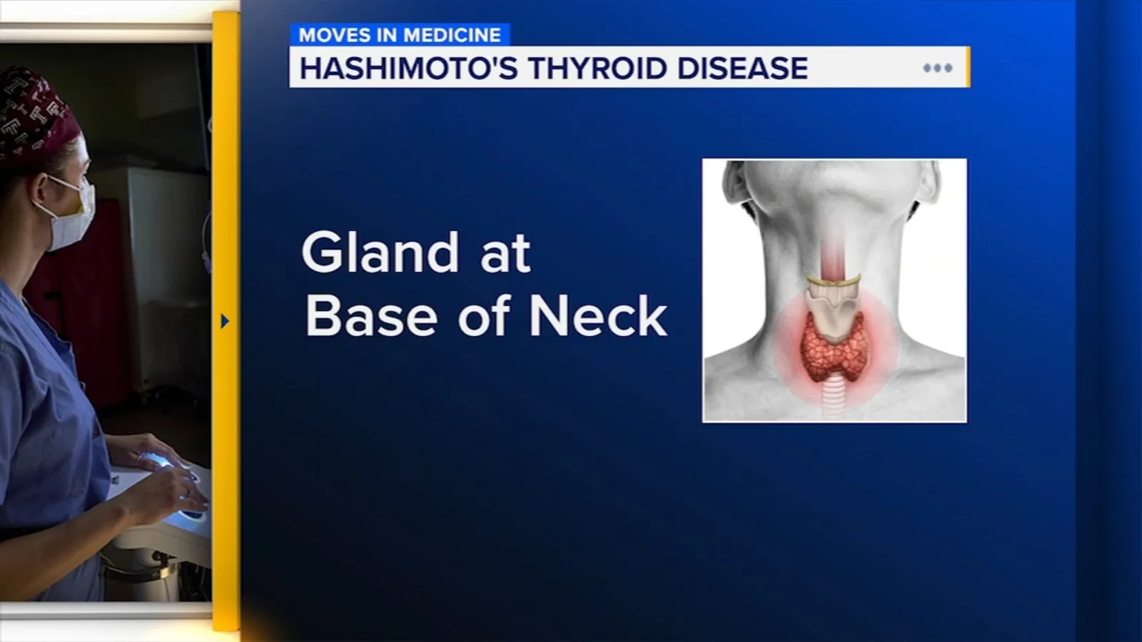 Understanding Hashimoto's Thyroiditis: A Common Yet Overlooked Condition