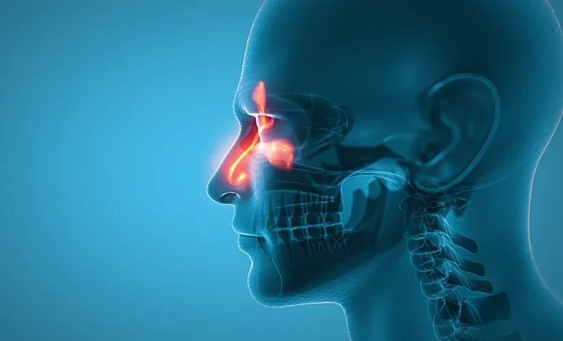 Exploring Multispecific Antibodies for Chronic Rhinosinusitis Treatment