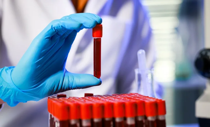 Nationwide Study Links Renal Hyperfiltration to Cardiovascular Risks