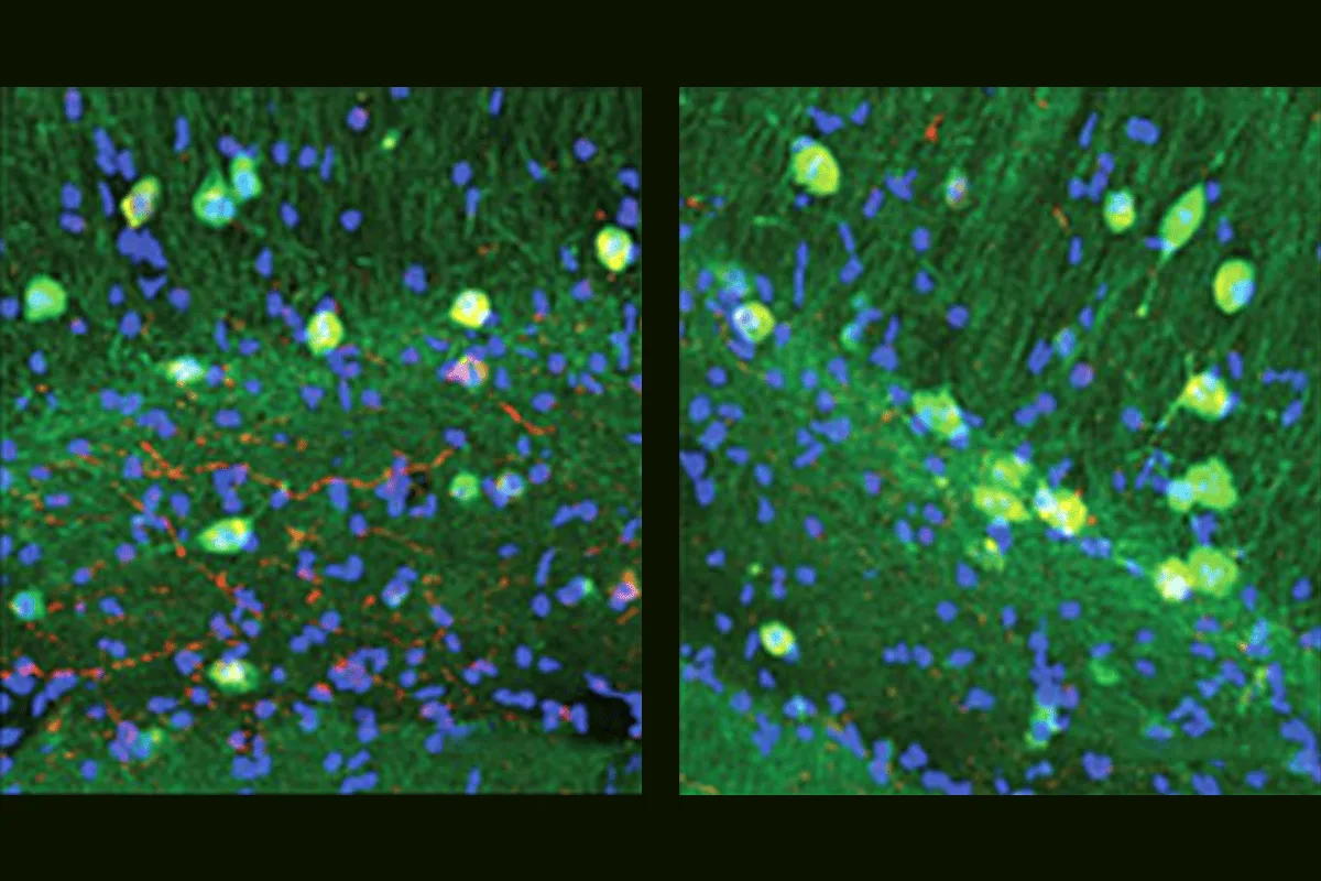New Study Identifies Behavioral Subtypes Linked to Autism in Zebrafish