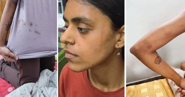 Delhi Protestors Allege Police Assault During Detention