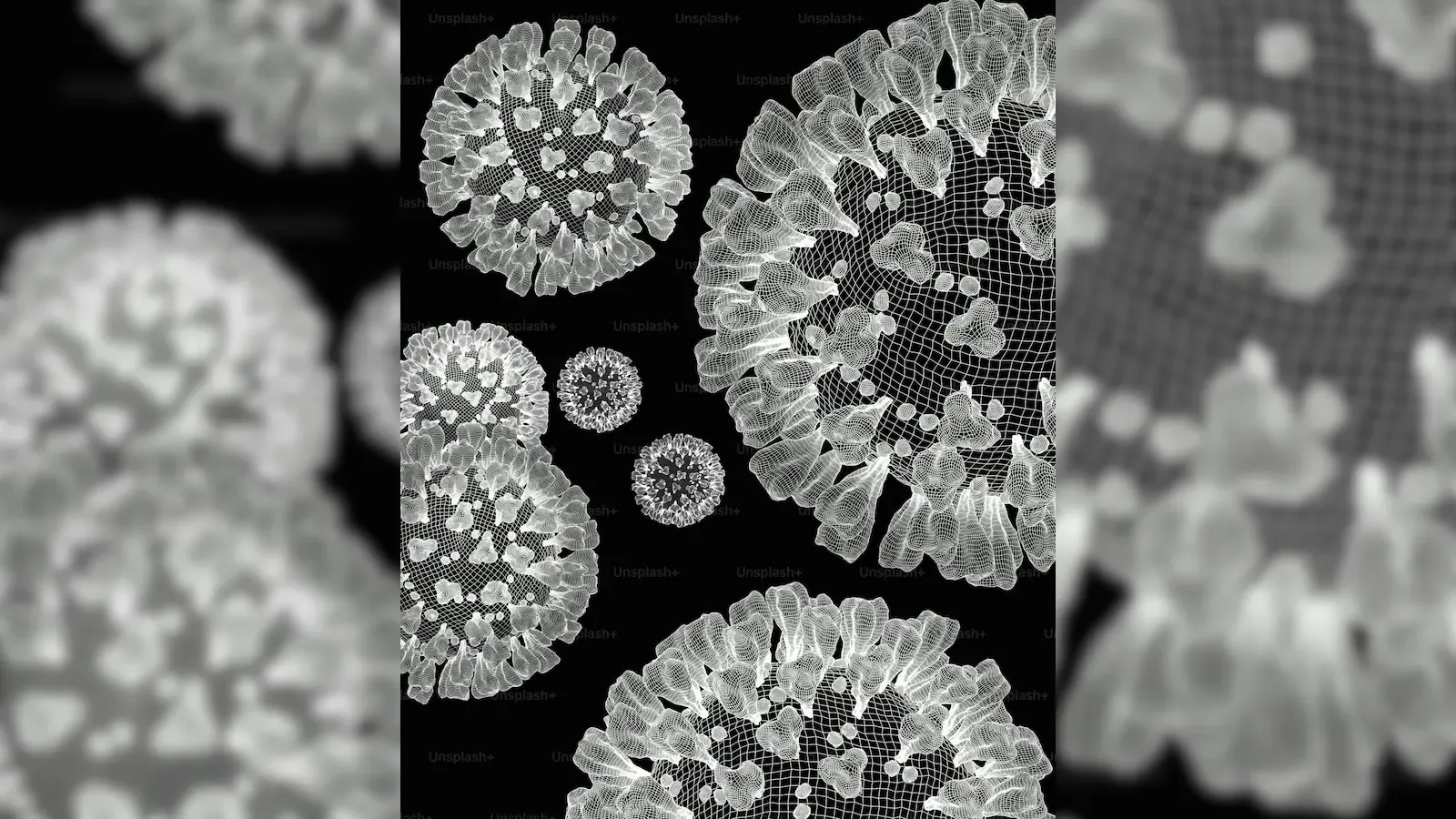 First Human Case of Shamonda Virus Confirmed in France